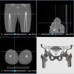 3D打印人體骨骼 哈佛大學孵化企業為中國醫生打造本土化軟件平臺